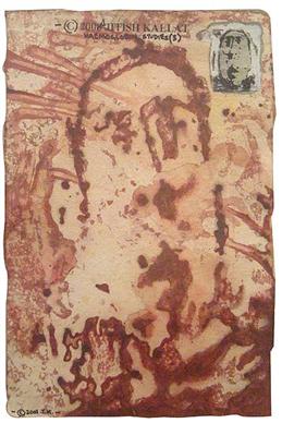 Haemoglobin Series - 2