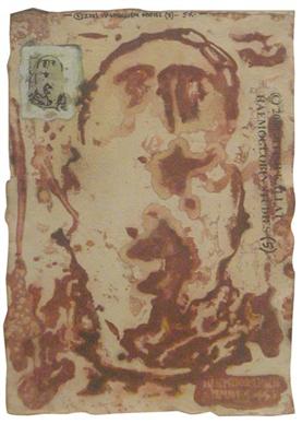 Haemoglobin Series - 4