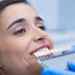 Veneers in Mechanicsburg PA