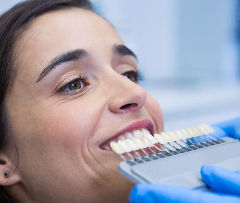 Veneers in Mechanicsburg PA