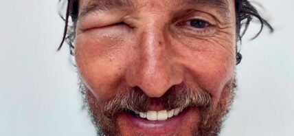 Matthew McConaughey gets stung by a bee