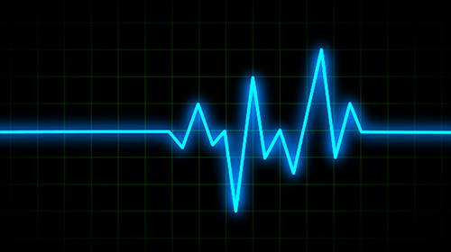 PULSE PULSE