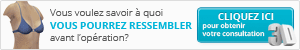 Voyez votre nouveau vous avant l'intervention