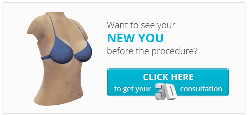 Want to see your new you before the procedure?
