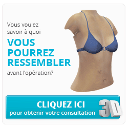 Want to see your new you before the procedure?