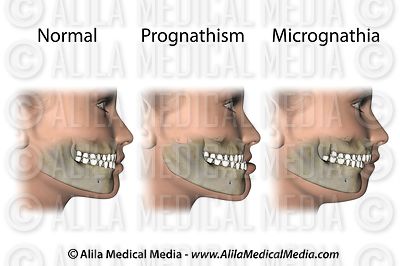 mouth jaw problems Images Videos  & Oral & Medical Dentistry  Alila Media Health