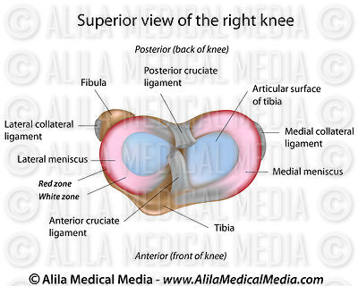 Alila Medical Media | Orthopaedics & Sport Medicine Images & Videos