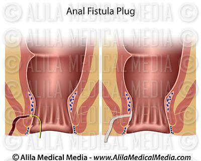 Alila Medical Media | Digestive System Images