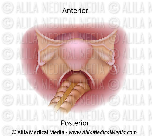 Alila Medical Media | Female reproductive system top view unlabeled