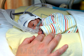 Baby Stephen born at the Rotunda Hospital 13 weeks early weighing 1 lb 2 oz.