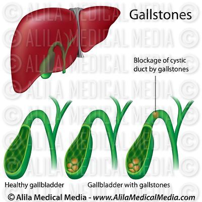 Alila Medical Media | Digestive System Images
