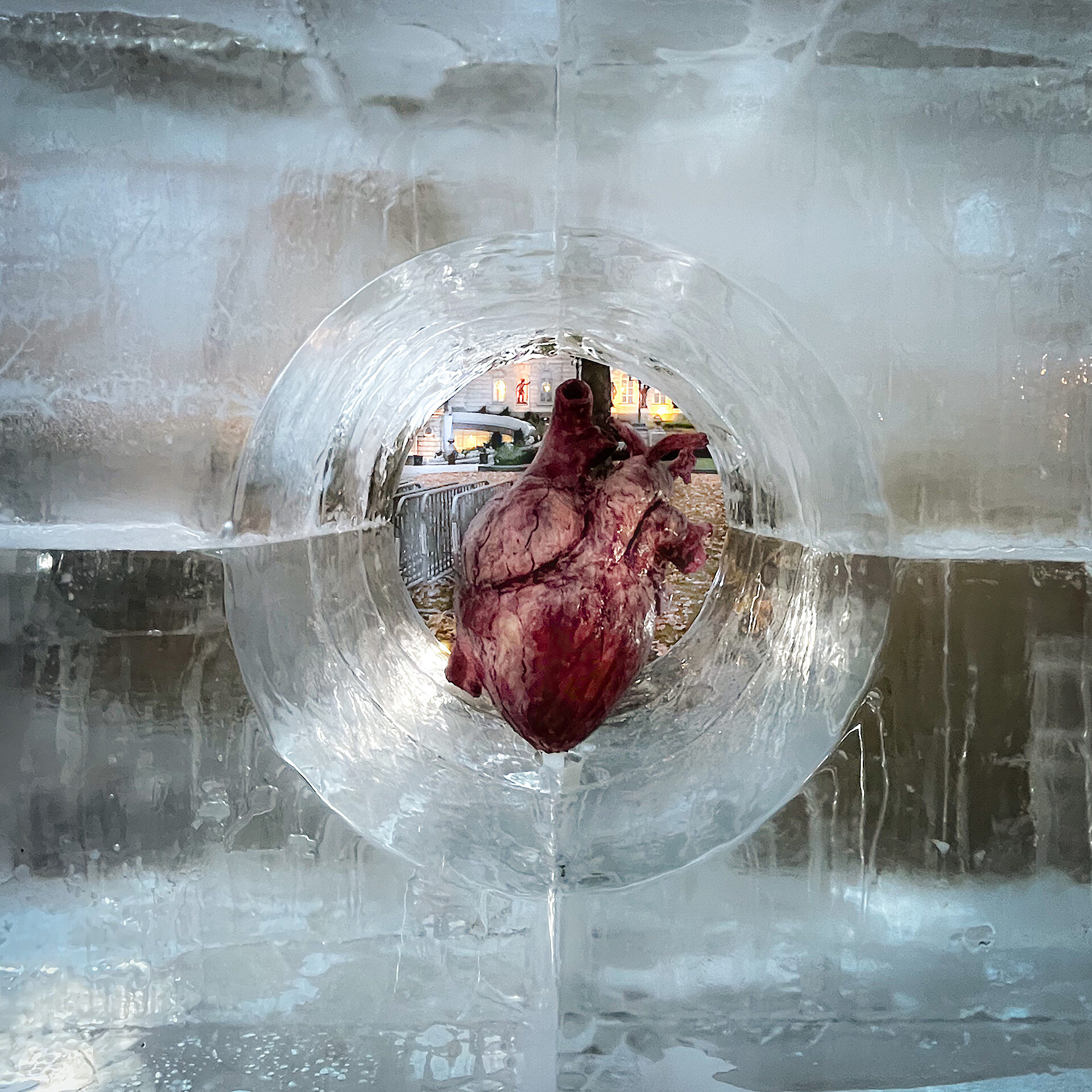 LG2 Transplant Quebec 01