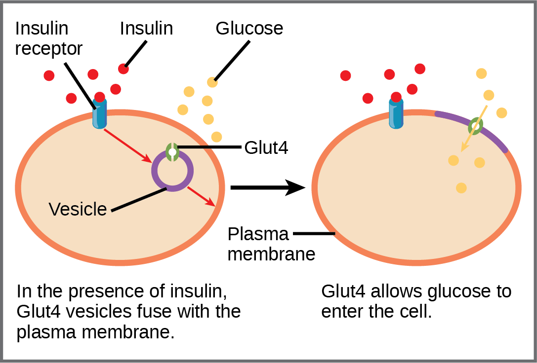 When insulin in the bloodstream binds the insulin receptor in the plasma membrane of a target cell, a vesicle containing the glucose transporter Glut-4 fuses with the plasma membrane. Glut-4 is a transporter that allows glucose to enter the cell.