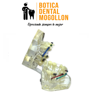 MAQUETA DENTAL DE ORTODONCIA IMPORTADO