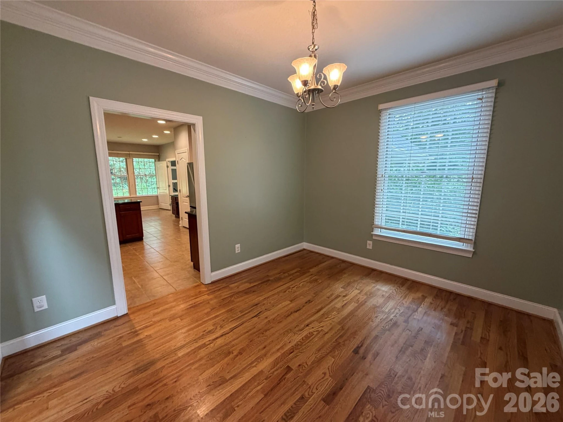11 Jupiter Hills Drive - Photo 9