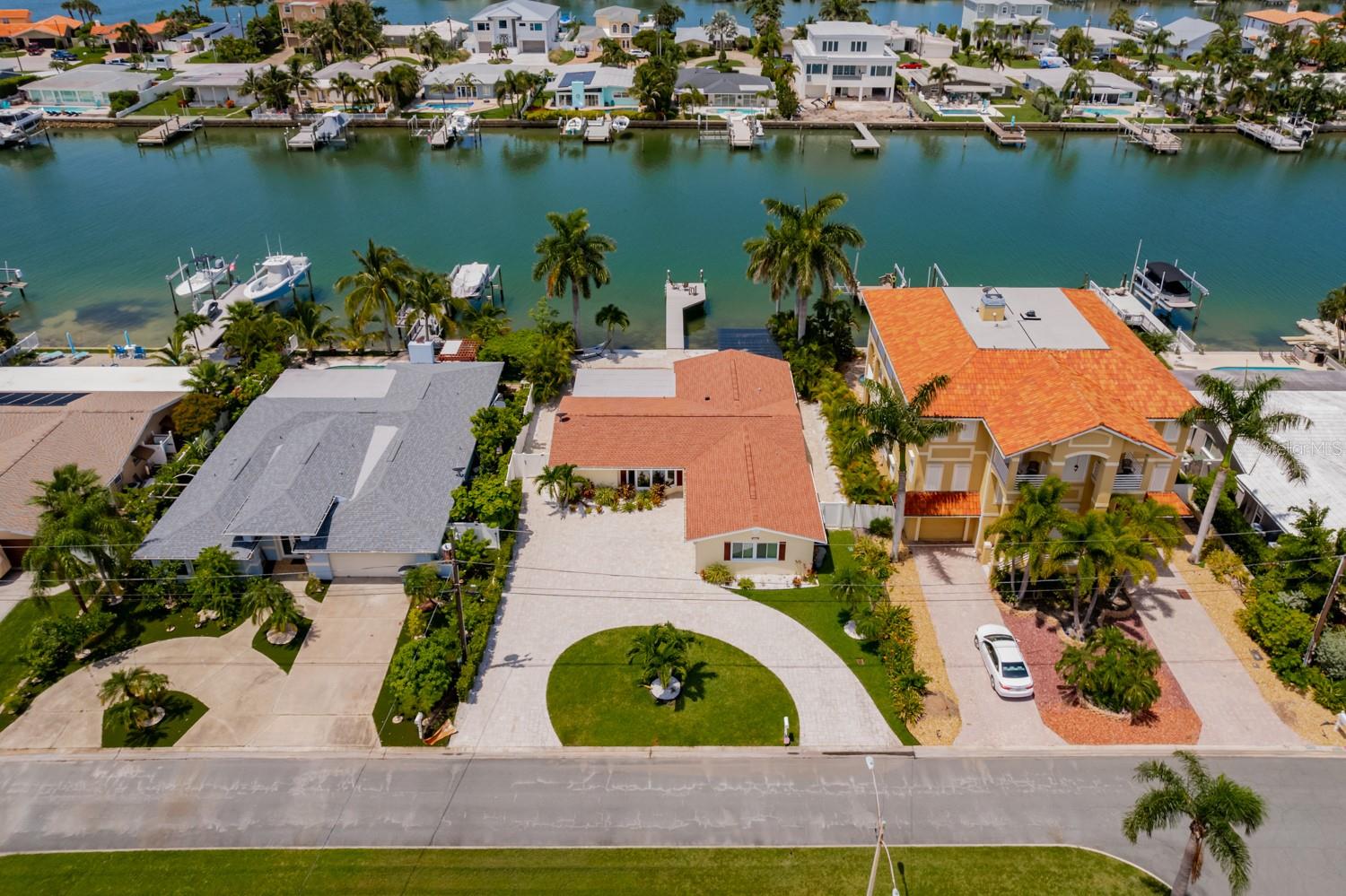 11240 7TH ST E, TREASURE ISLAND, FL, 33706