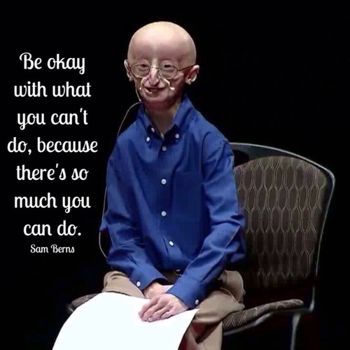 progeria sam berns