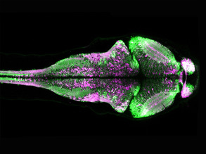 Snapping Brain Activity