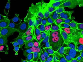 Prostate Cancer Reprogramming