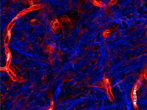 Youth and Macroph-age