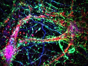 Neuronal Nanotubes