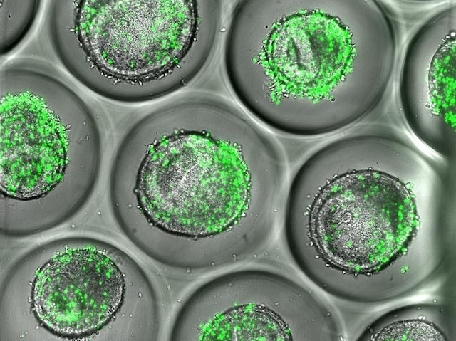 New Improved Organoids
