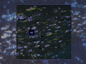 Following Synthetic Invasion