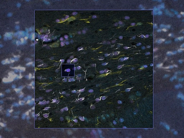 Following Synthetic Invasion