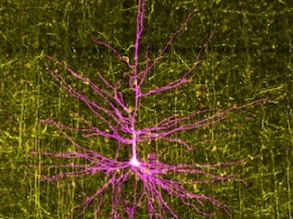 Tumours and Seizures