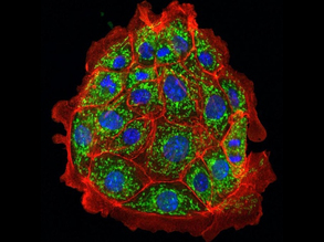 Stopping Ceramide Damage