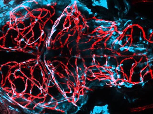 Vessel Vulnerability