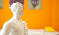 Acupedics Acupuncture & Herbal Medicine: Acupuncture