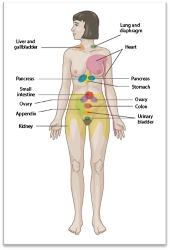 locations for referred pain