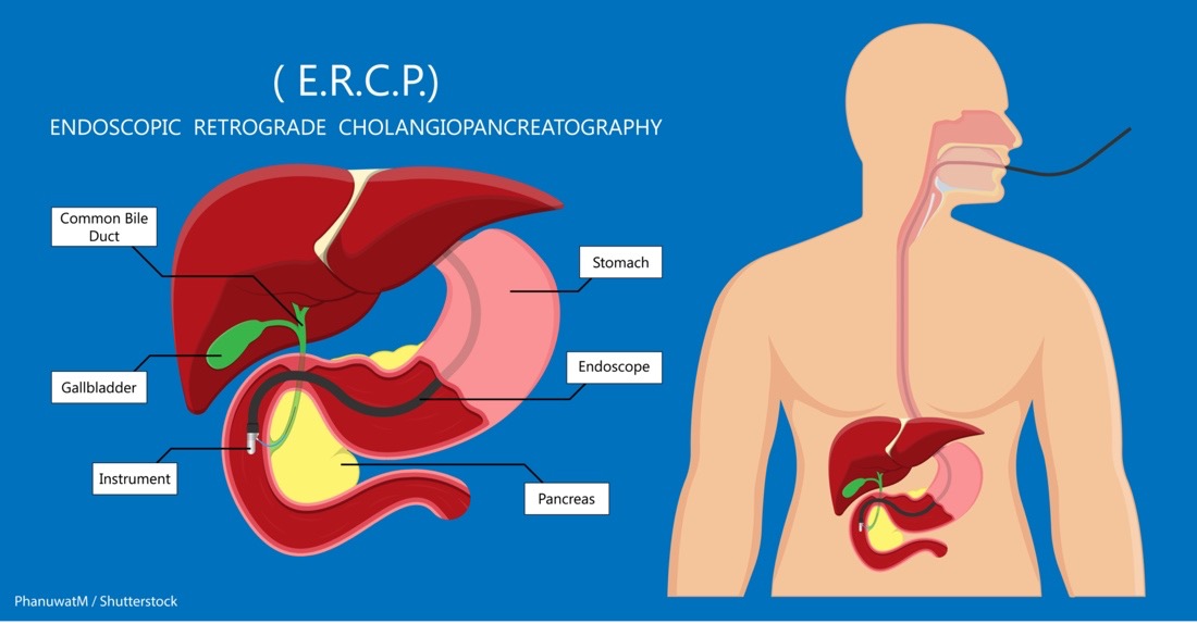 A diagram of the internal organs of the human bodyDescription automatically generated
