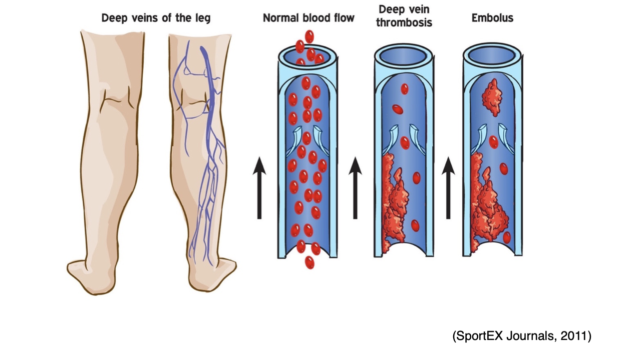 Blood Clotting and Bleeding Disorders for APRNs Nursing CE Course