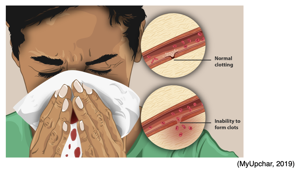 Blood Clotting and Bleeding Disorders for APRNs Nursing CE Course