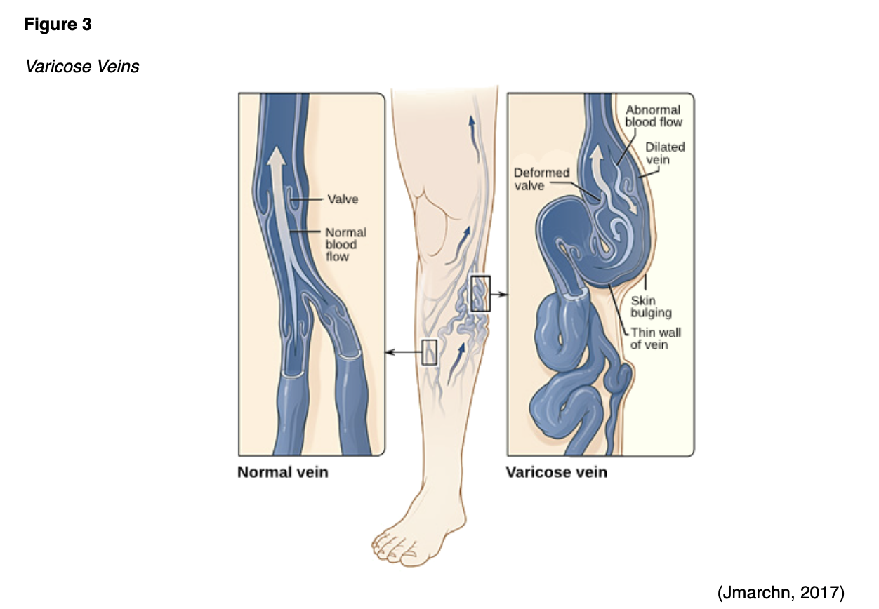 Blood Clotting in Pregnancy and Postpartum for APRNs Nursing CE Course