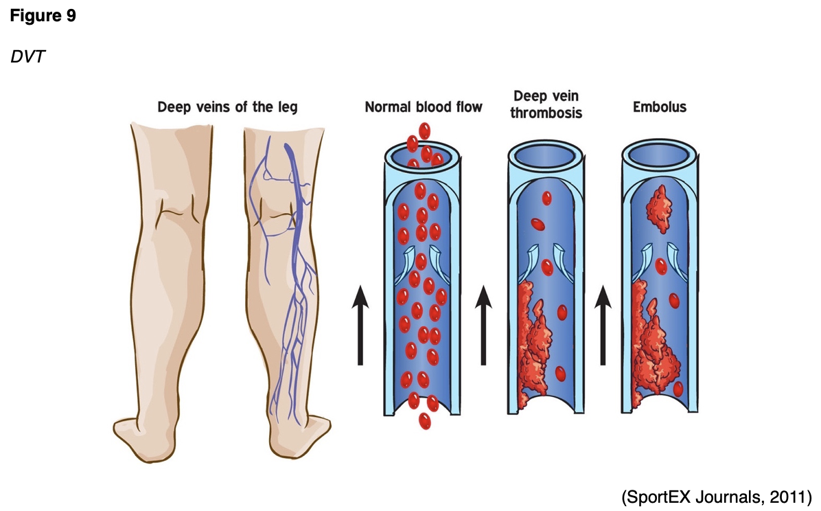 Blood Clotting and Bleeding Disorders for RNs & LPNs Nursing CE Course NursingCE