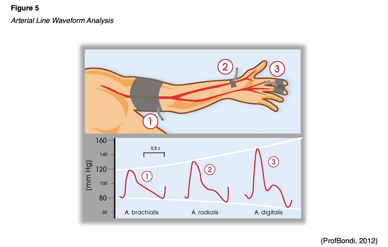 Vascular Access Devices Part 1 Nursing CE Course NursingCE