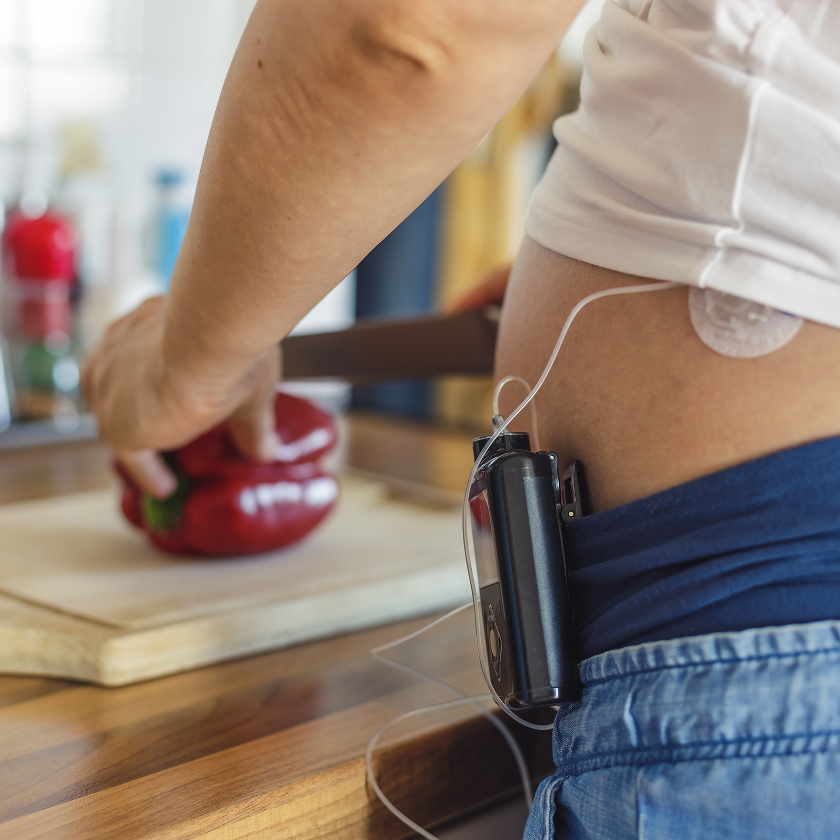 Insulin Pump image number null