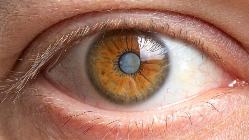 New Study Links Weight-Loss Drugs to Serious Eye Conditions and Vision Loss