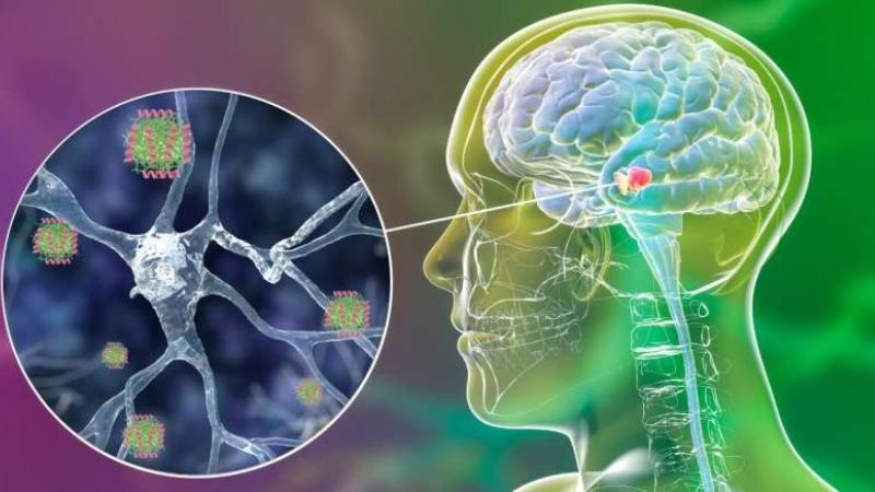 Scientists Block Brain Cell Death in Parkinson’s Study