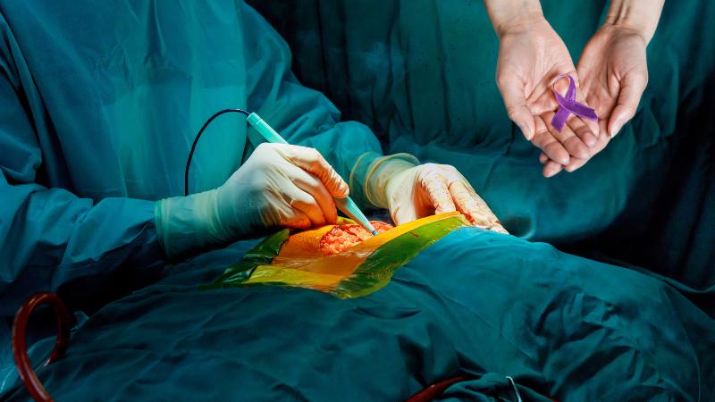 Michigan Woman Survives 15-Pound Tumor After High-Risk Surgery in Chicago