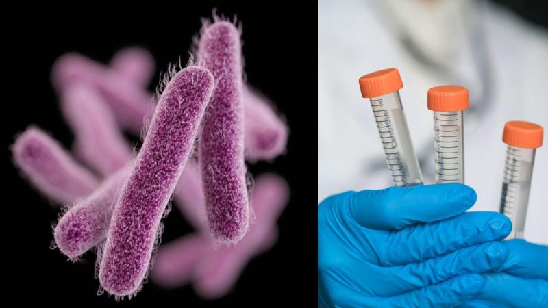 CDC warns of rising extensively drug-resistant shigella cases in US