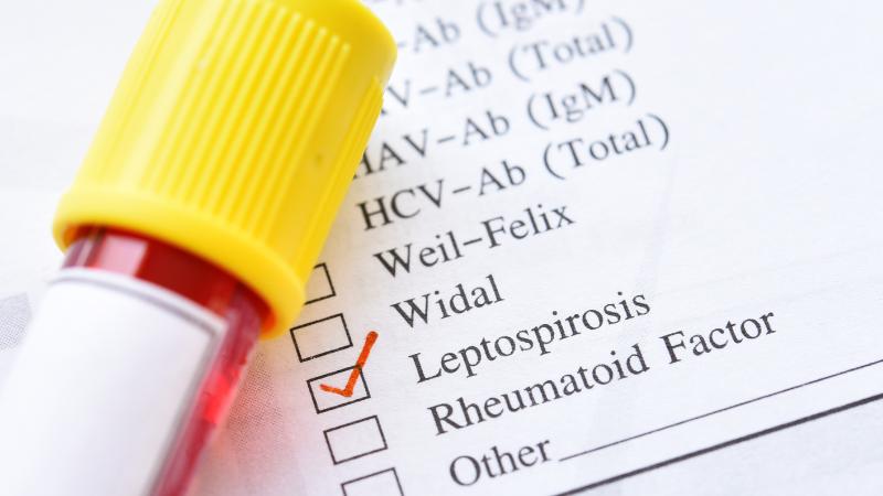 Chicago reports leptospirosis cases with one death linked to rat exposure