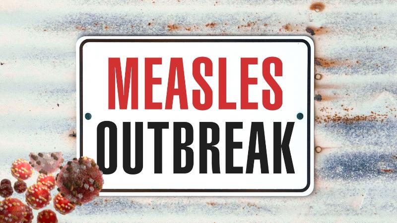 Measles Outbreak Spreads in Kentucky as US Cases Near 30-Year High
