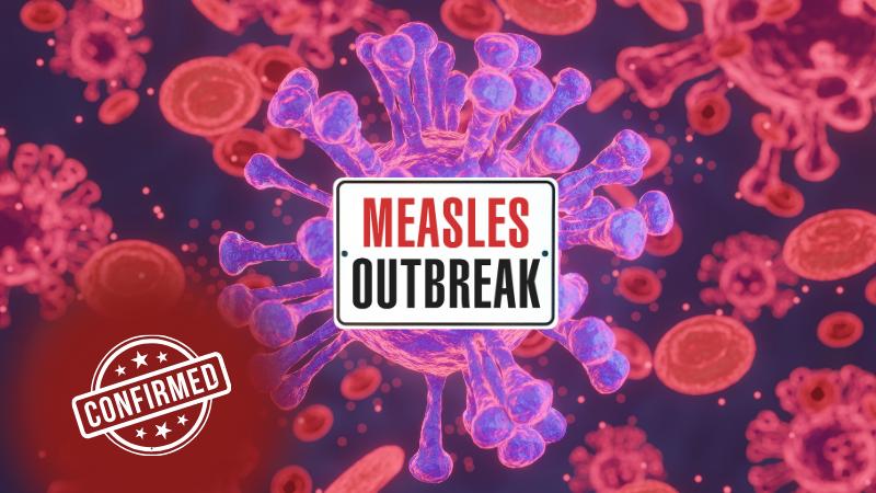 Measles Outbreak in Harris County  Health Authorities Confirm First Case of 2025