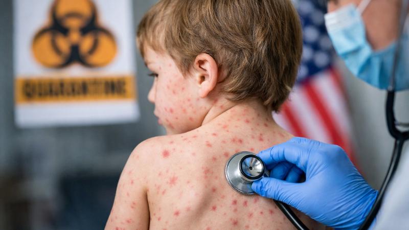 Virginia reports second measles case of year, officials trace possible exposure sites