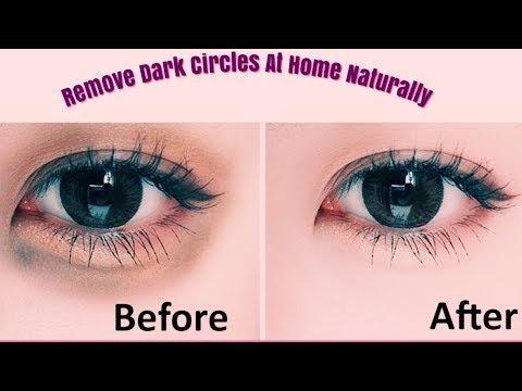 Effective Desi Home Remedies for Dark Circles Natural Solutions for Brighter Eyes