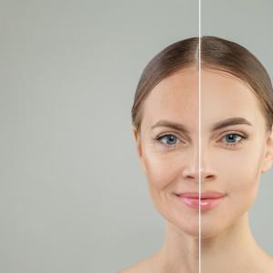 How Do Anti Aging Skin Care Products Help Prevent Visible Skin Aging